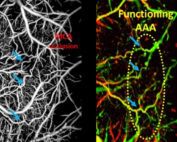 Monitoring arteriogenesis at the cerebral arteriolo-arteriolar anastomoses (AAAs) in mouse brain during middle cerebral artery occlusion using OCT-based microangiography (OMAG) (left) and Doppler OMAG (right).