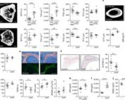 : Deficiency or inhibition of S1P lyase results in higher bone mass and strength, altered OC activity and increased plasma OPG