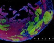 stems cells in monkey heart