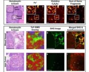 H&E, ToF-SIMS, and SHG images of vasculature and blood lakes.